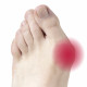 Гелевий протектор на великий палець Vitamed 5th Toe Gel Bunion Pad