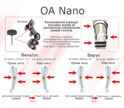 DJO Global Ортези для остеоартрозу OA Nano Medial лівий