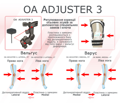 DJO Global Ортези для остеоартрозу OA ADJUSTER 3 Lateral правий